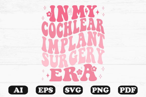 Real-World Review: In My Cochlear Implant Surgery Era Retro